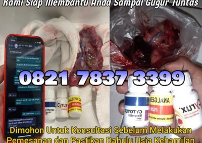 Jual Obat Aborsi Cytotec, 082178373399 Misoprostol Asli, dan Gastrul di Apotek Menggugurkan Kandungan Di Dairi Cod