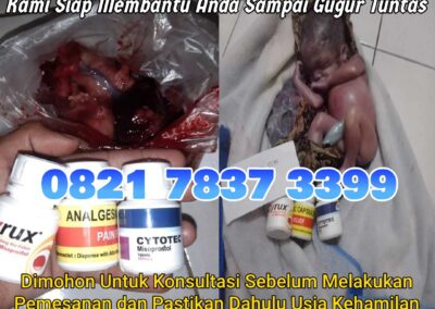 Jual Obat Aborsi Cytotec, 082178373399  Misoprostol Asli, dan Gastrul di Apotek Menggugurkan Kandungan Di Nias Selatan