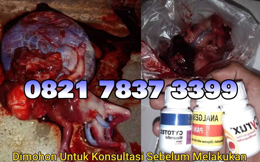 Jual Obat Aborsi Cytotec, 082178373399 Misoprostol Asli, dan Gastrul di Apotek Menggugurkan Kandungan Di Madailing Natal Cod