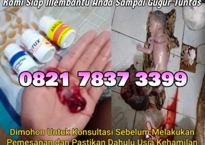Jual Obat Aborsi Cytotec, 082178373399  Misoprostol Asli, dan Gastrul di Apotek Menggugurkan Kandungan Di Nias Barat