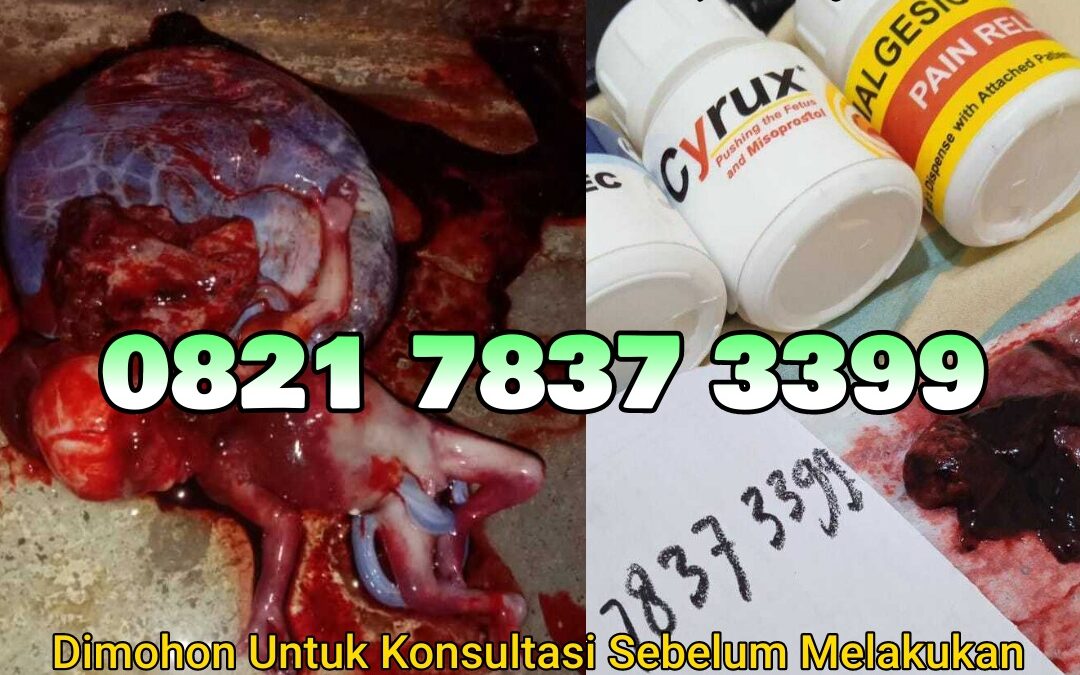 Jual Obat Aborsi Cytotec, 082178373399 Misoprostol Asli, dan Gastrul di Apotek Menggugurkan Kandungan Di Padang Lawas