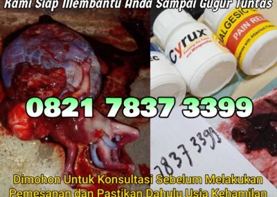 Jual Obat Aborsi Cytotec, 082178373399  Misoprostol Asli, dan Gastrul di Apotek Menggugurkan Kandungan Di Padang Lawas