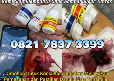 Jual Obat Aborsi Cytotec, 082178373399  Misoprostol Asli, dan Gastrul di Apotek Menggugurkan Kandungan Di Padang Lawas Utara