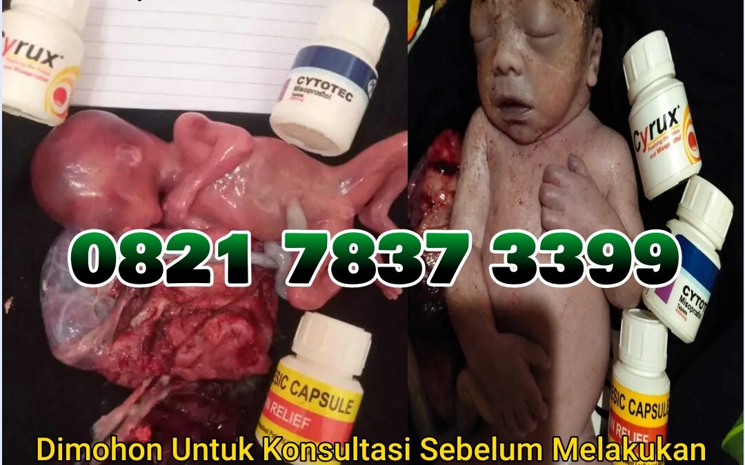 Jual Obat Aborsi Cytotec, 082178373399 Misoprostol Asli, dan Gastrul di Apotek Menggugurkan Kandungan Di Deli serdang Cod