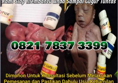 Jual Obat Aborsi Cytotec, 082178373399  Misoprostol Asli, dan Gastrul di Apotek Menggugurkan Kandungan Di Langkat Cod
