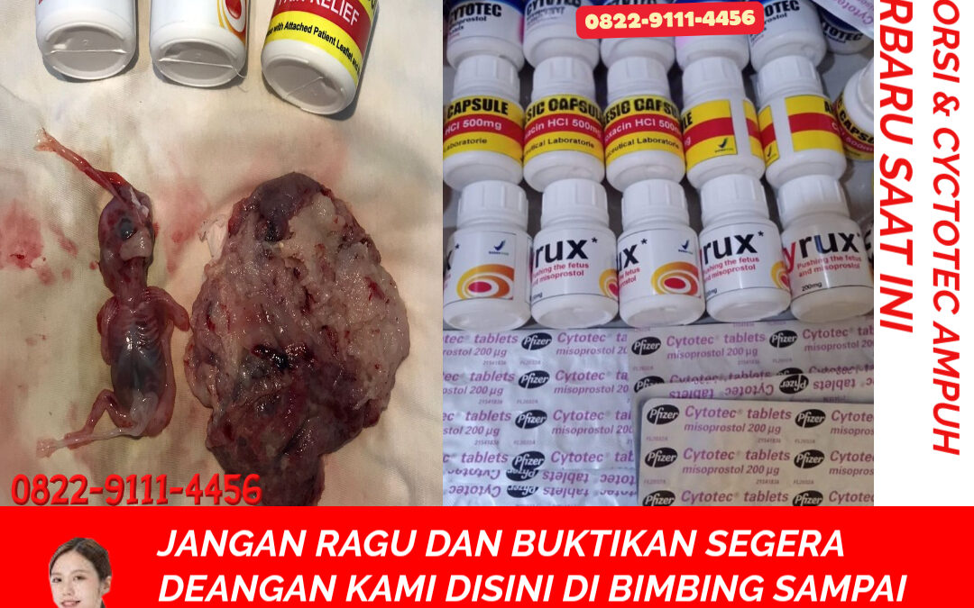 Obat Penggugur Kandungan Cytotec 082291114456 Gastrul di Apotik Pasaman Barat