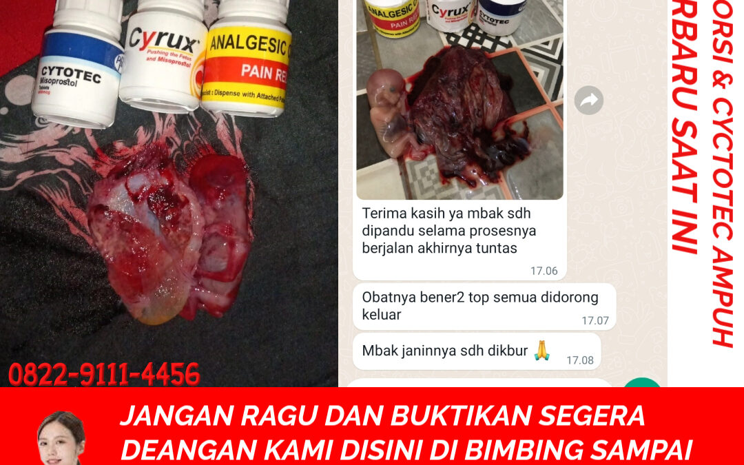 Obat Penggugur Kandungan Cytotec 082291114456 Gastrul di Apotik Padang Pariaman