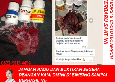 Obat Penggugur Kandungan Cytotec 082291114456 Gastrul di Apotik Solok Selatan