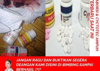 Obat Penggugur Kandungan Cytotec 082291114456 Gastrul di Apotik Solok